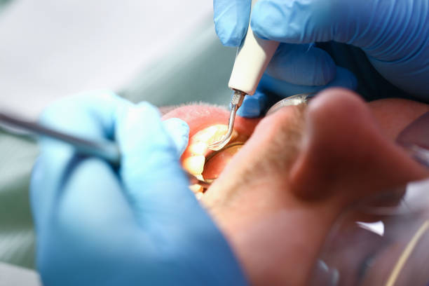 Best Pediatric Emergency Dentist in Chester, PA